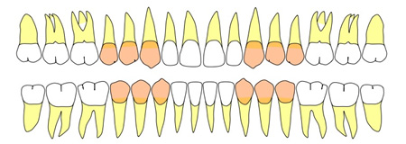 側方歯群